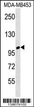 ANKRD20A3 Antibody (C-term)