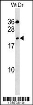 CLEC2D Antibody (Center)