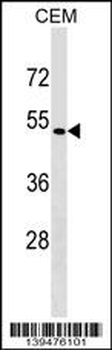 SSTR5 Antibody (C-term)