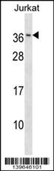 RAB8B Antibody (C-term)