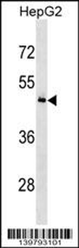 KHDRBS3 Antibody (N-term)