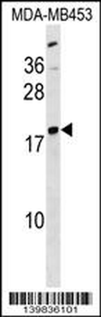 LYPLA1 Antibody (Center)
