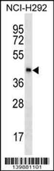 SPESP1 Antibody (C-term)