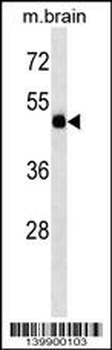 TBC1D10A Antibody (Center)