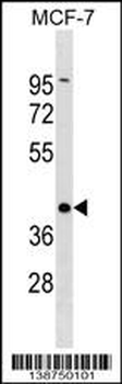 DMRT1 Antibody (C-term)