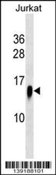 ATP6V1F Antibody (C-term)
