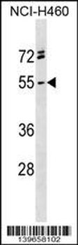 RGMA Antibody (C-term)