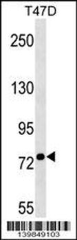 BEST3 Antibody (N-term)