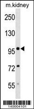 Mouse Sdccag1 Antibody (N-term)