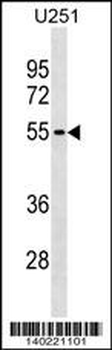 KLHDC7B Antibody (C-term)