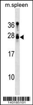 Mouse Tusc1 Antibody (Center)