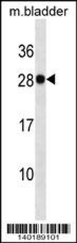 Mouse Lgals3 Antibody (Center)