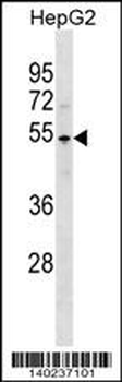 PKNOX1 Antibody (C-term)
