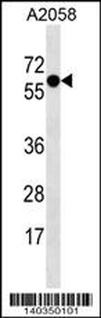 SYT4 Antibody (N-term)