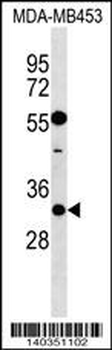 KCNIP2 Antibody (N-term)