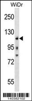 KIT Antibody (Center Y568/Y570)