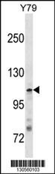 JMY Antibody(N-term)