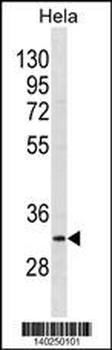 BRMS1 Antibody(N-term)