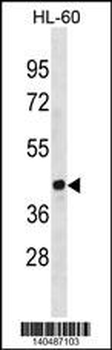 EVX1 Antibody(Center)