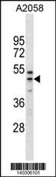 RFFL Antibody(C-term)