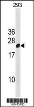 RGS13 Antibody(Center)