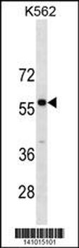 PBX3 Antibody(N-term)