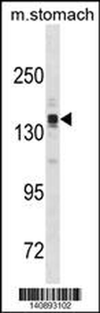 ASTN2 Antibody(N-term)