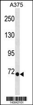 EOMES Antibody(N-term)