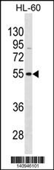 VIPR1 Antibody(C-term)