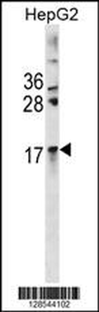 CRYAA Antibody(Center)