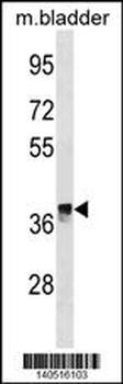 CRYM Antibody (Center)