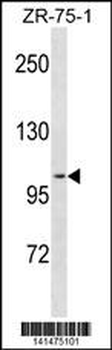 PGR Antibody (C-term)