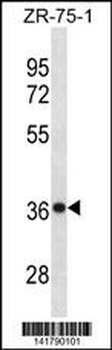 CHORDC1 Antibody (Center)