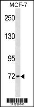 CPT2 Antibody (Center)