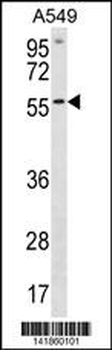 ETV5 Antibody (N-term)