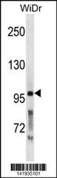 PCSK5 Antibody (N-term)