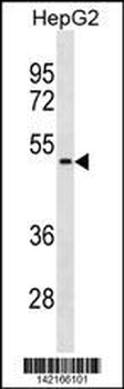 NEU1 Antibody (Center)