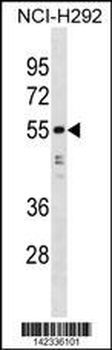 HNRNPH1 Antibody (N-term)