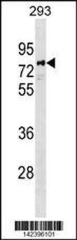 PARP6 Antibody (C-term)