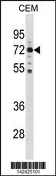 MAK Antibody (C-term)