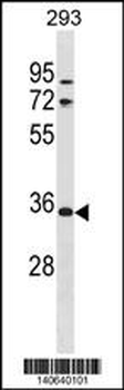 VSIG2 Antibody (C-term)