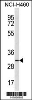 TMIGD2 Antibody (Center)
