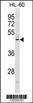 CMKLR1 Antibody (C-term)