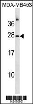 RNASE1 Antibody (N-term)