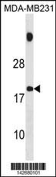 SPNXB Antibody (Center)