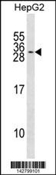 KCNMB2 Antibody (N-term)