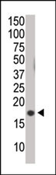 Phospho-Histone H3(S10) Antibody
