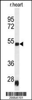 Rat Serpinh1 Antibody (Center)