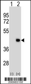 DPPA2 Antibody