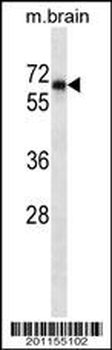 PTPN11 Antibody